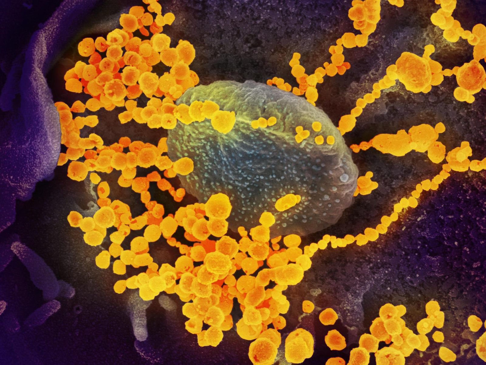 World Health Organization monitorea nuevas variantes de virus respiratorios