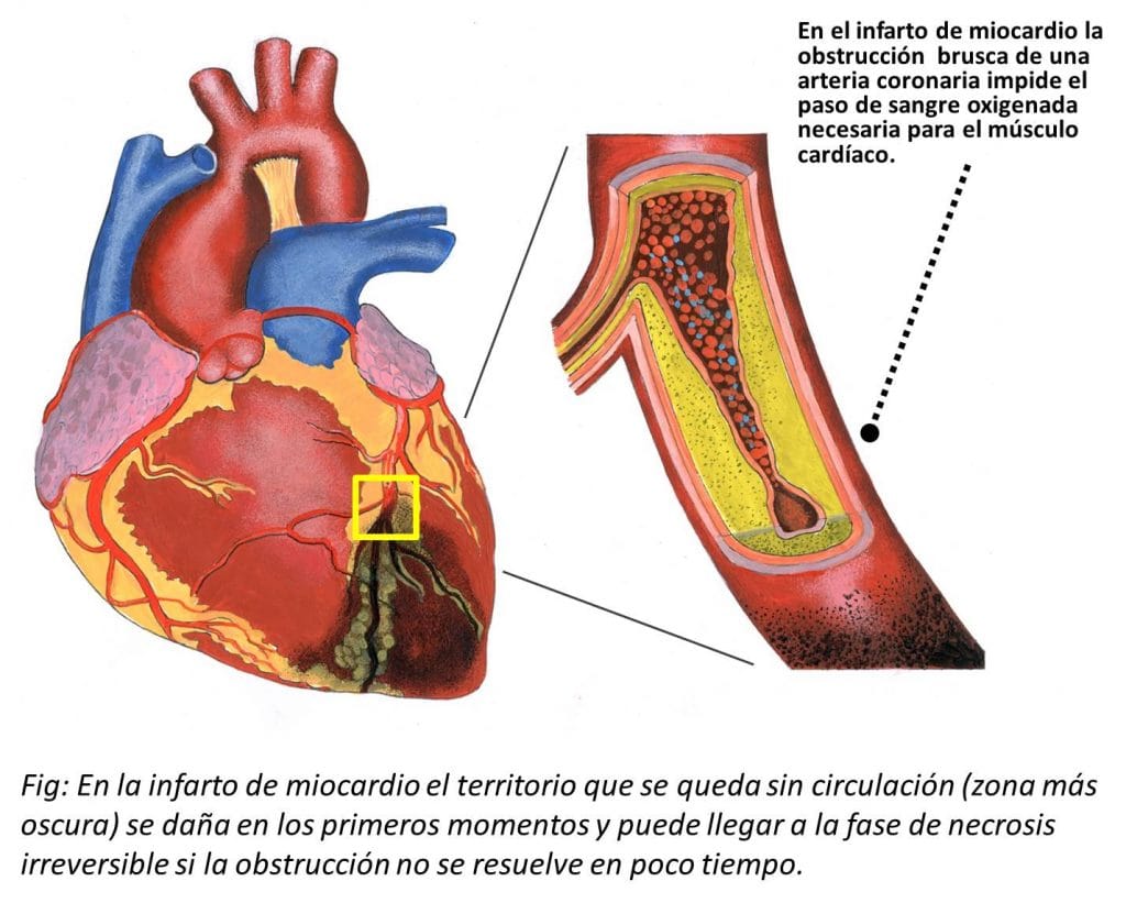 Mujer muere de infarto tras conocer que su hijo y su nieto fueron heridos